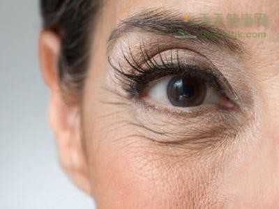 眼角皱纹的日常处理方法